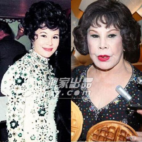 单眼皮的照片,有网友踢爆她曾于上海整容失败导致鼻孔一大一小