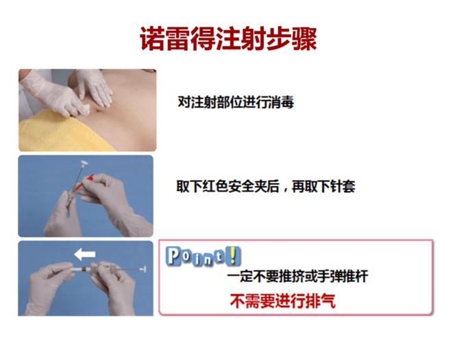 诺雷得的注射
