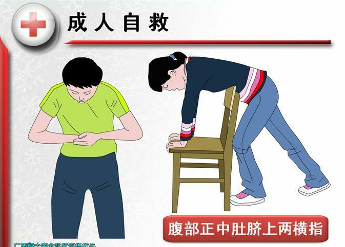 春季传染病预防和喉气管异物急救知识讲座