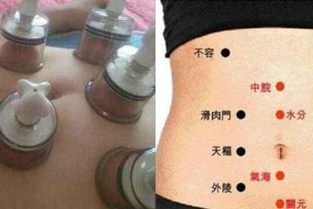 拔罐减肚子拔哪里图解教大家几种瘦身方式