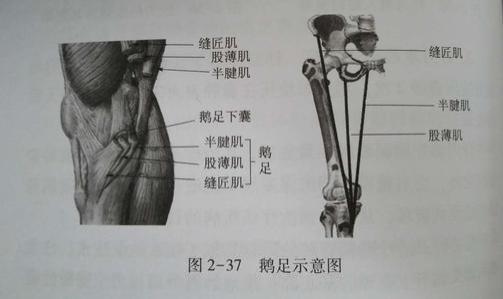 可能是鹅足肌腱炎!