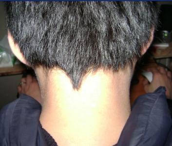 后脑勺的头发尾部聚在一起尖尖的,怎么弄