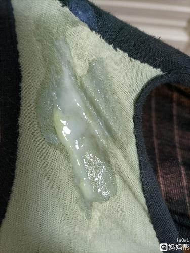 这是宫颈粘液吗  感觉不像是白带 因为平时白带没有那么一股脑那么多