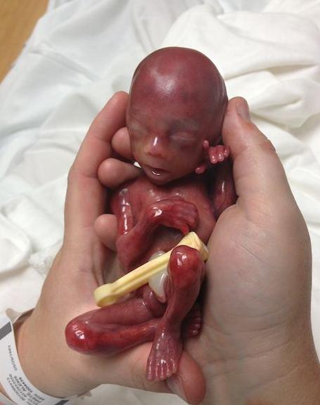 标签:            分娩生产方式生孩子生产痛楚分娩痛胎头大小