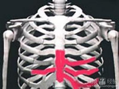 肋软骨炎是怎么引起的
