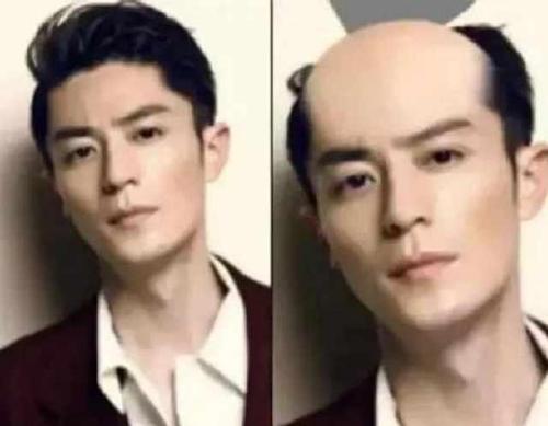 那么,以上的这些明星秃头照,你觉得谁的最好看呢?