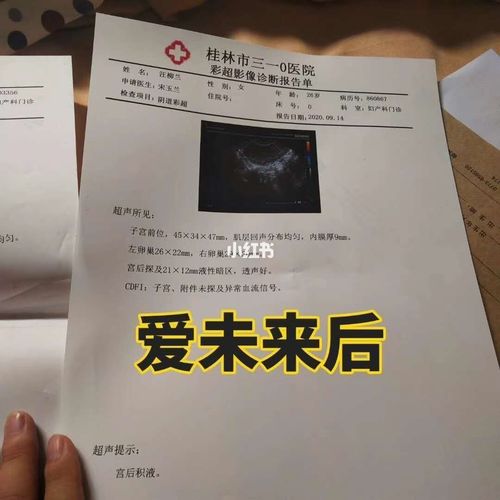 宫颈囊肿好啦_医疗健康_医疗健康其他