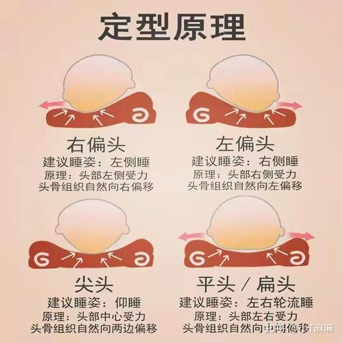 头型影响颜值如何帮助宝宝睡出完美头型