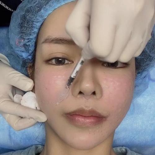 水光针到底要不要经常打?