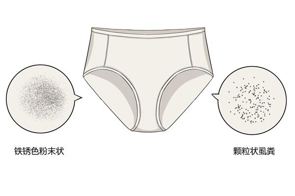 如何判断是否得了阴虱病