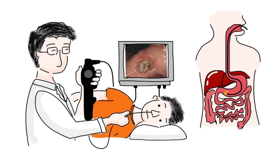 小林历险记二:胃镜大揭秘