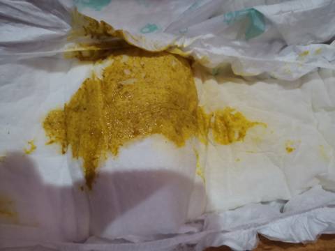 请问拉这样的大便是拉稀吗?母乳喂养