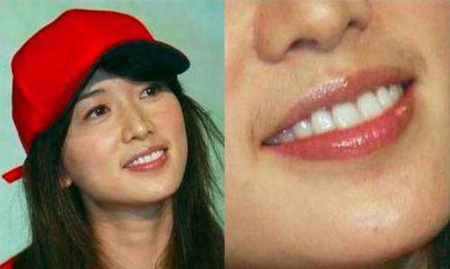 唇毛重的女明星里最出名的刘涛算一个!