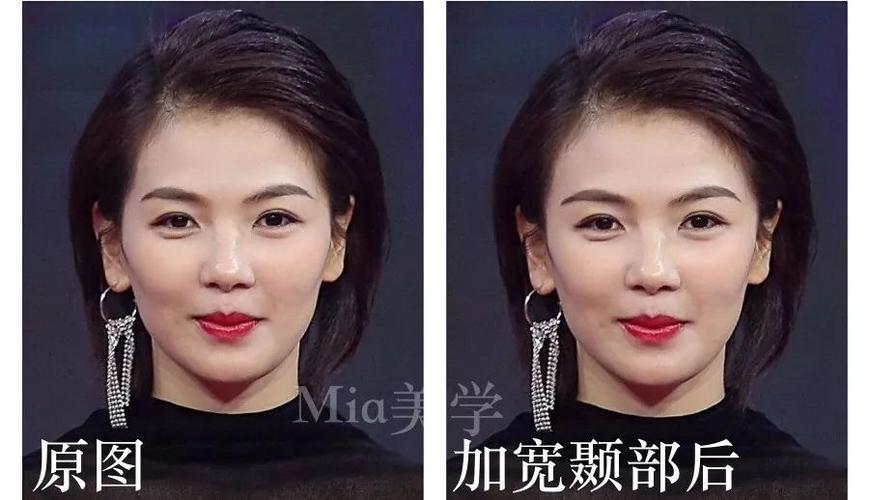 这部分人,常常会误把问题怪到颧骨上. 再看个日本女明星例子,绫濑遥.