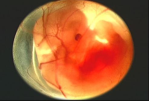 从怀孕一个月到怀孕十月每个月胎儿的发育图都在这里了真全