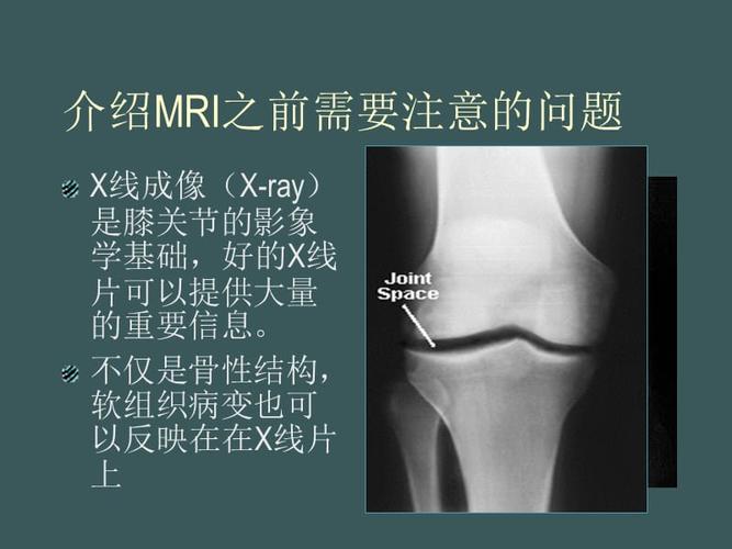 如何阅读膝关节磁共振图象ppt演示幻灯片