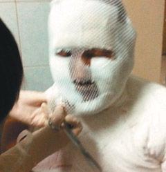 齐秦烧伤后首发声:脸部没问题 很快就会露面