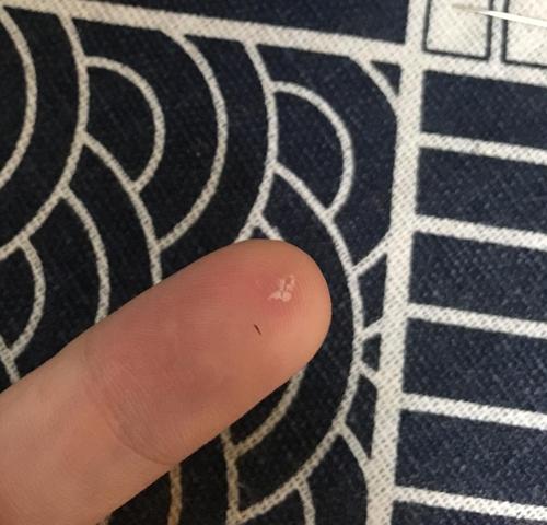 拔出手指中的小刺