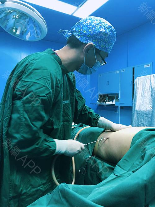 烟台鹏爱探店 | 直播腰腹吸脂全过程!做个小腰精,挺好!