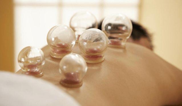 拔罐时后背出现的瘀血是排出的毒素或许与你想67的67不一样