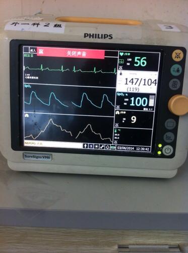 这心电图是心脏病吗
