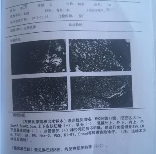 水滴保理赔案例:中年确诊乳腺癌,医疗险多次快速理赔让她重拾生活信心