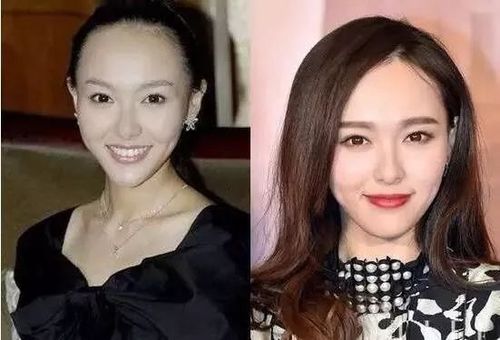 90后集体脱发变秃了……姑娘,请珍惜你的秀发!