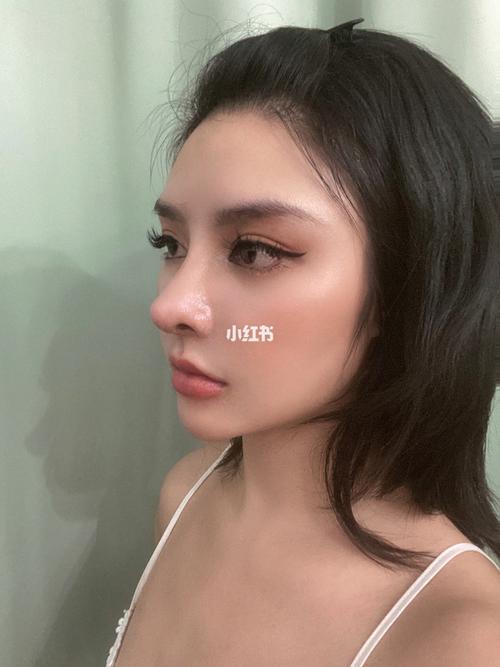 眉弓前后对比_混血感_整形_膨体眉弓_美妆_医美整形