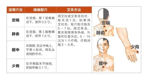 艾灸之内科常见疾病治疗(一)