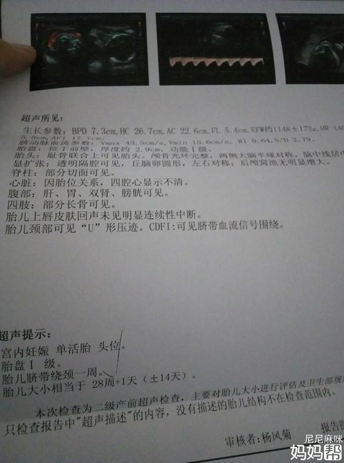 28周胎盘成熟度就已经1级了