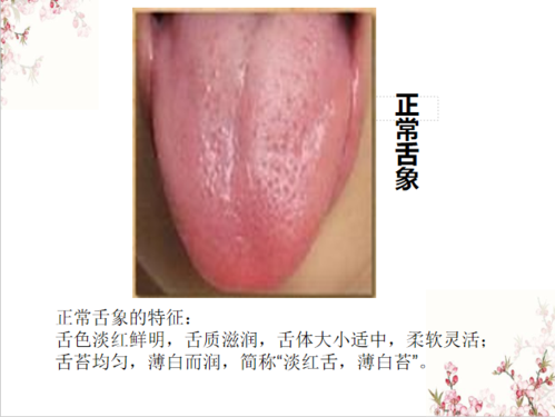 正常舌像:舌淡红,苔薄白