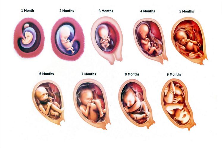 2)左枕前位对顺产的影响   左枕前位的胎儿头部朝下,且胎头枕骨