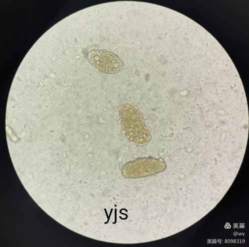 未受精蛔虫卵～杨金生