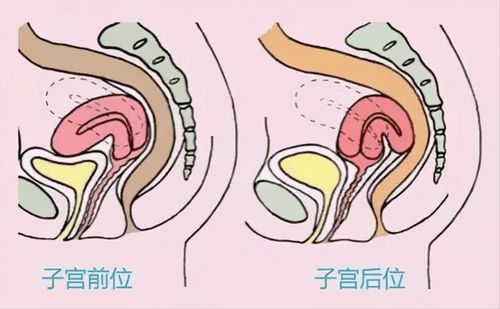 子宫前位比子宫后位更容易受孕?备孕的夫妻要了解