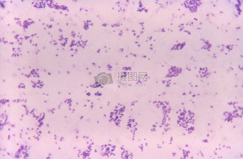 这种显微照片显示土拉弗朗西斯菌细菌的存在,前身为巴氏杆菌tul 图片