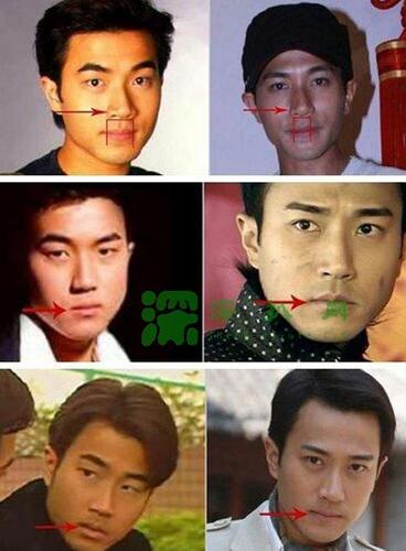 刘恺威有没有整容 刘恺威整容前后对比照片
