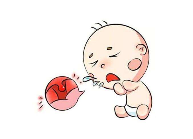 急性支气管炎简介