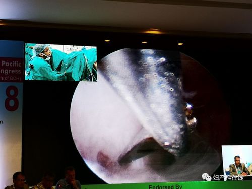 宫腔镜下冷器械宫腔粘连分离术