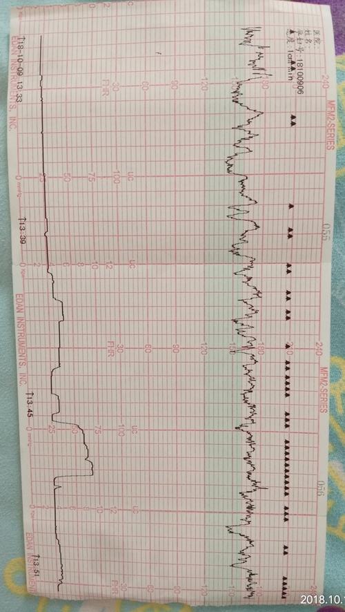帮我看一下,胎心监护和彩超单子