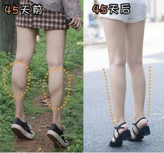 万变不离其宗,就是拉长小腿后肌肉!