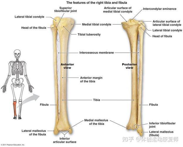 胫骨外翻会造成 腓骨小头突出么?