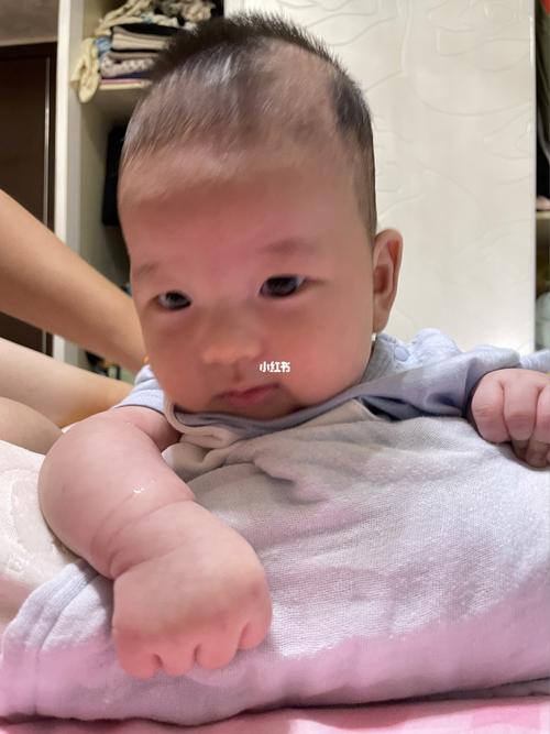 宝宝快三个月了 头有点歪要干预吗_宝宝斜颈_母婴