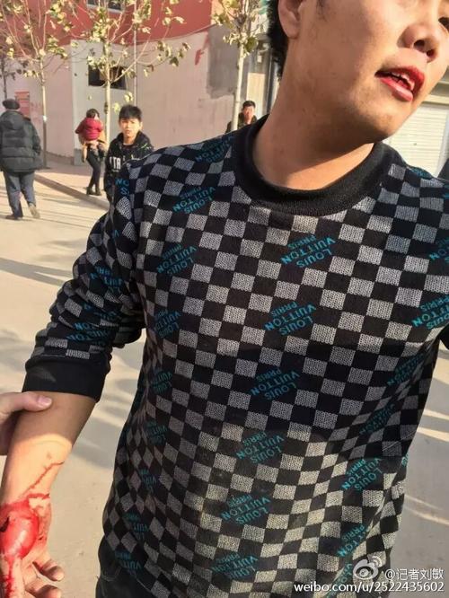 惨不忍睹河北永年农民张继印自焚抗议强拆