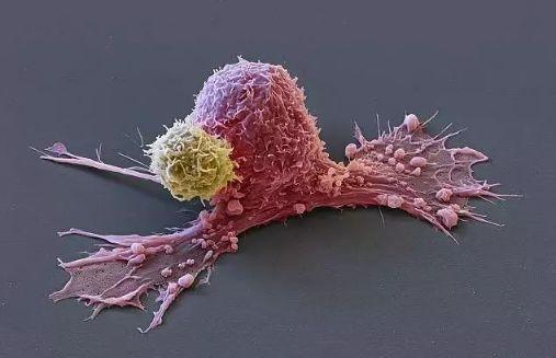 史上最清晰的cart细胞与癌细胞搏斗图像