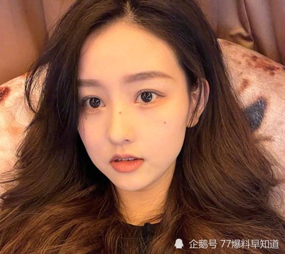 网红炫迈妹吃毒蘑菇,中毒休克,因祸得福减肥至80斤,胖瘦反差惊人