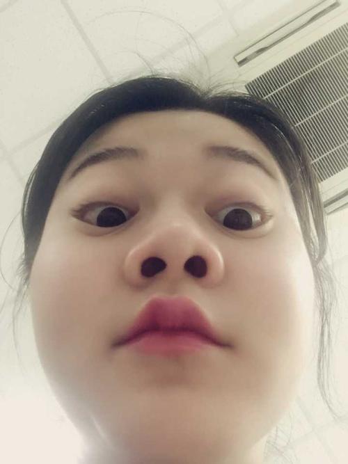 有没有因为鼻子不好看而毁了整张脸的例子?