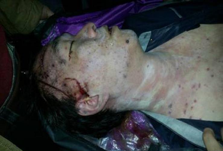 天花介绍_天花病因_天花治疗_天花医院医生_有来医生