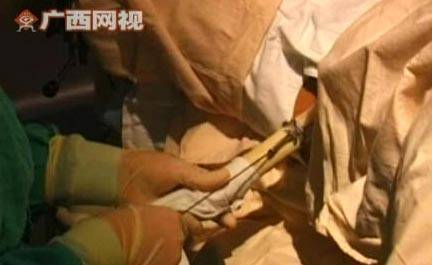 医院现场直播人工采精取卵全过程引争议[组图]