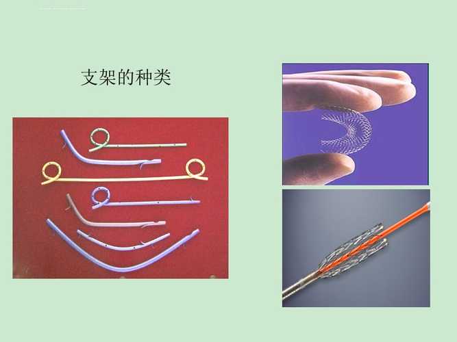 ercp下胆道胰管支架置入教程