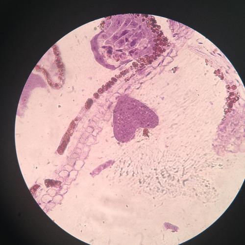 荠菜心形胚(给你一颗小心心)